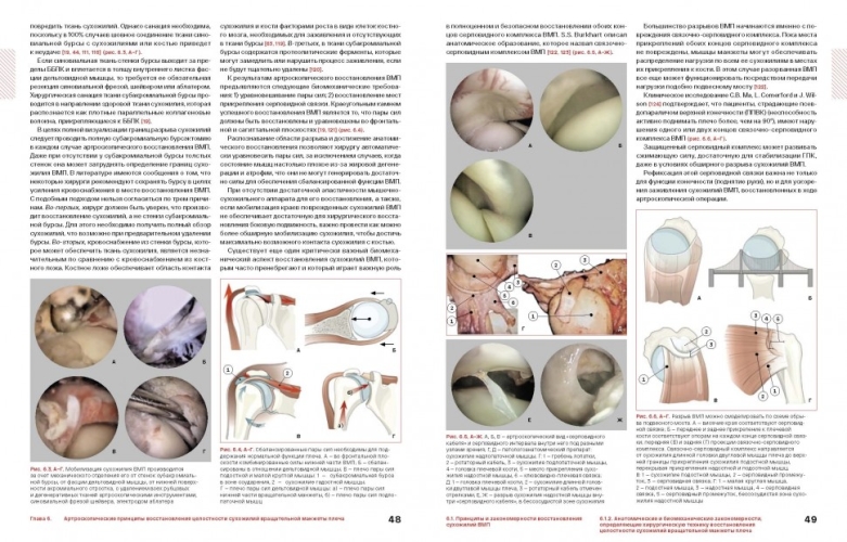 Спортивное плечо : В 3-х томах. Том 2: Вращательная манжета плеча (электронная книга)