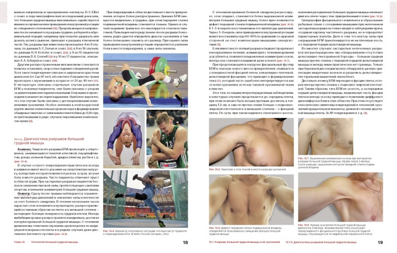 Спортивное плечо. В 3-х томах. Том 3. Эндопротезирование, травмы и реабилитация плечевого сустава